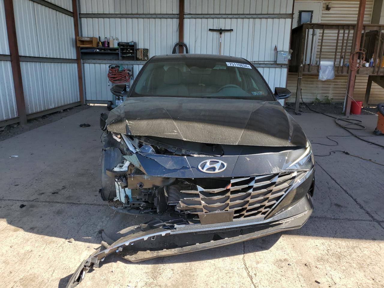 KMHLN4AG9NU288579 2022 Hyundai Elantra Sel