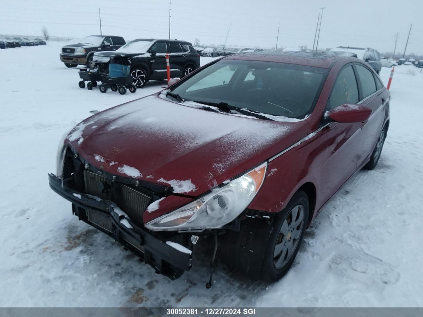 2013 Hyundai Sonata Se/Limited VIN: 5NPEC4AC4DH645854 Lot: 30052381