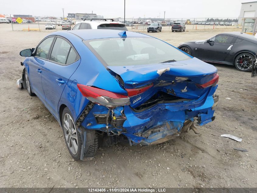 2017 Hyundai Elantra Se/Value/Limited VIN: KMHD84LFXHU249469 Lot: 12143405